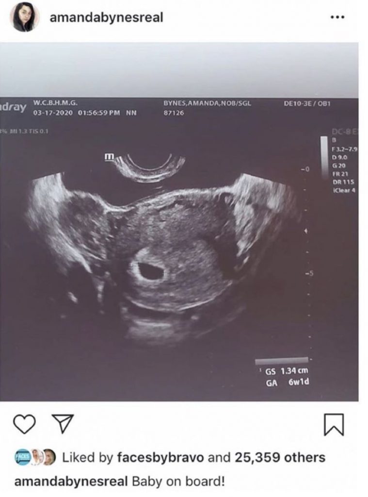 アマンダ・バインズが第1子の妊娠を発表